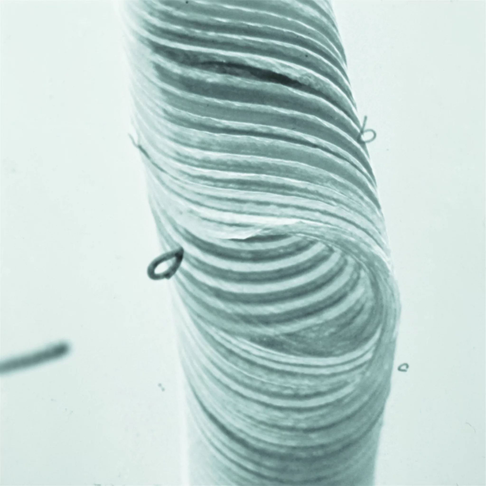 Micrografia elettronica del reperto
